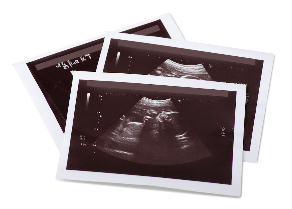 ultrasound